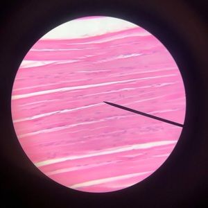 Meet your Posher, Memegan